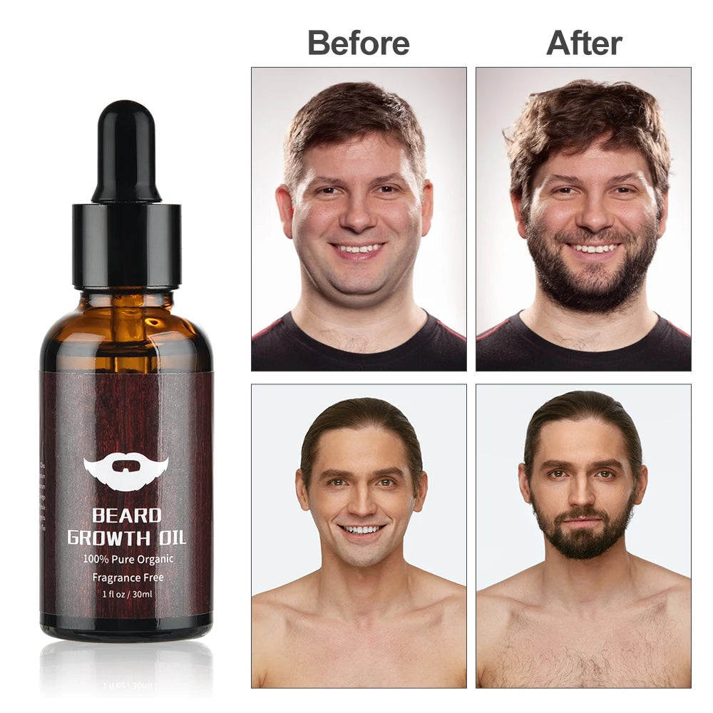 Beard Growth Essentials kit